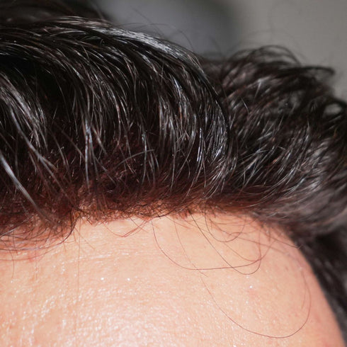 Prótesis Oscar Remy