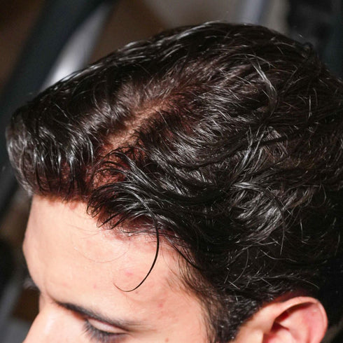 Prótesis Oscar Remy